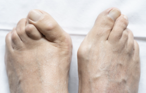 feettech-image-091